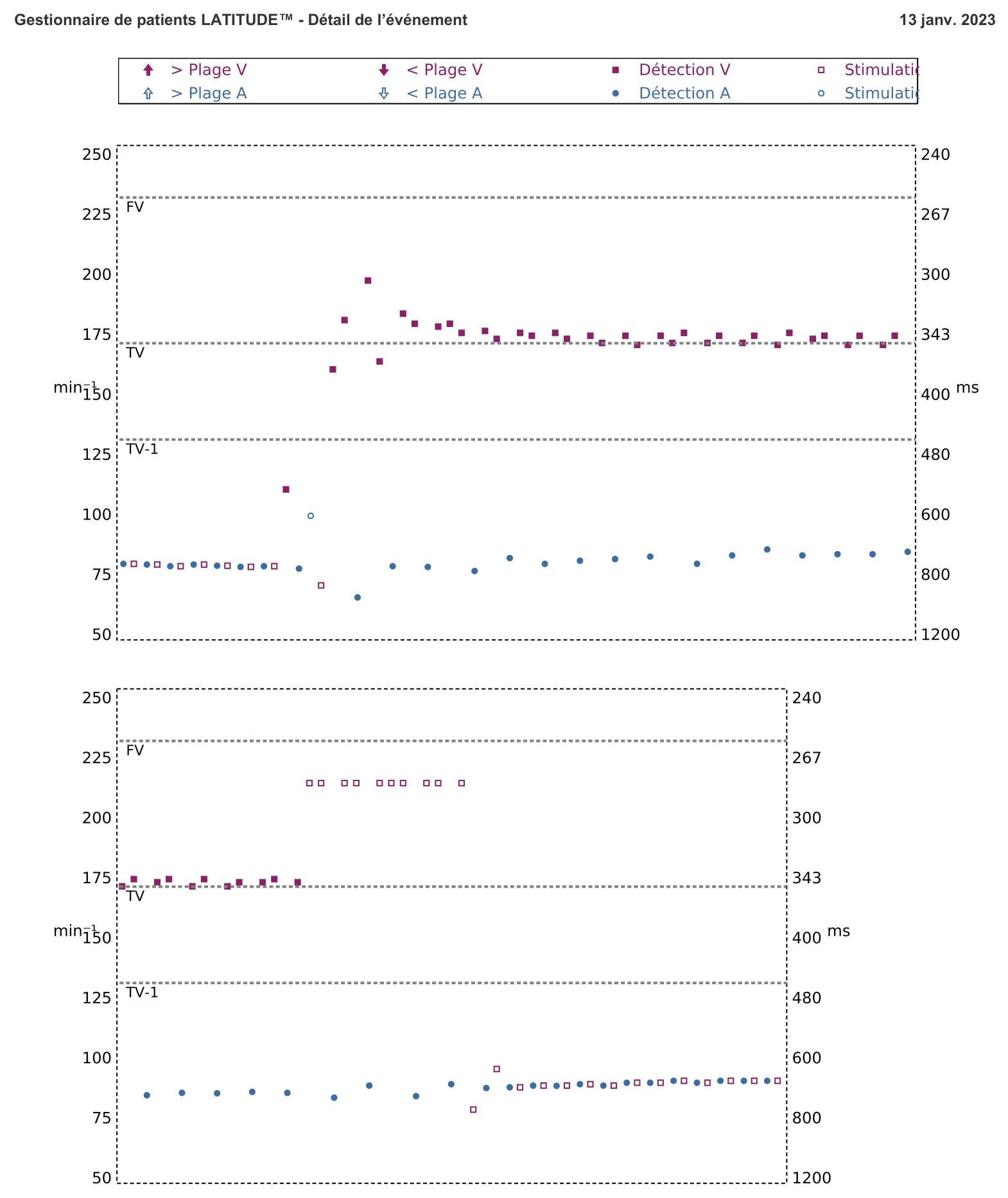 Figure — Stimulation anti-tachycardique en zone de TV