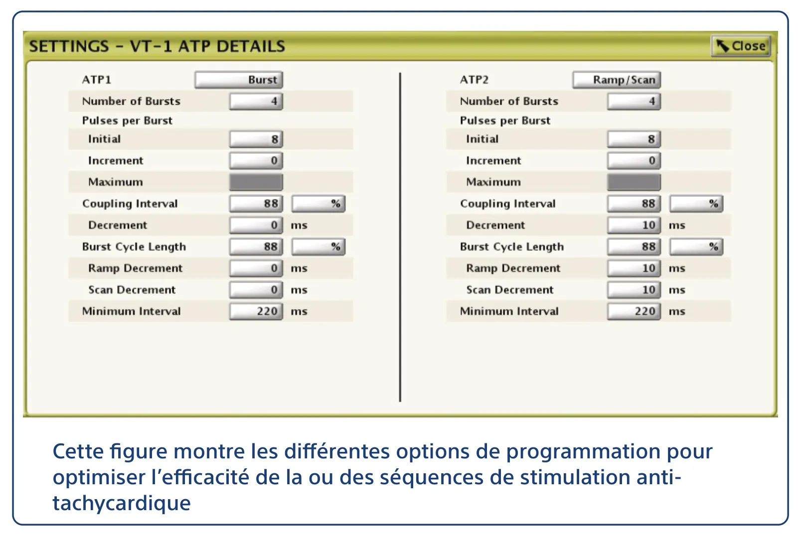 Cette figure montre les différentes options de programmation pour optimiser l’efficacité de la ou des séquences de stimulation anti-tachycardique