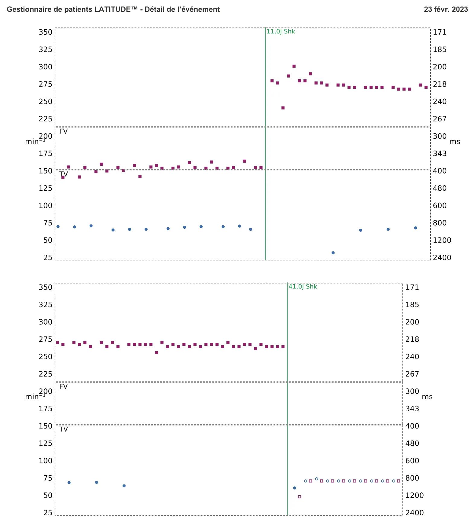 Figure — Choc à faible amplitude et accélération de l’arythmie