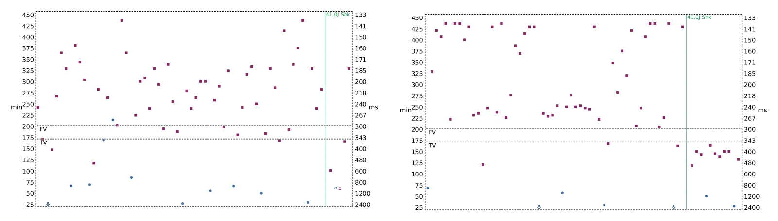 Figure — TV en zone de FV et seuil de défibrillation élevé
