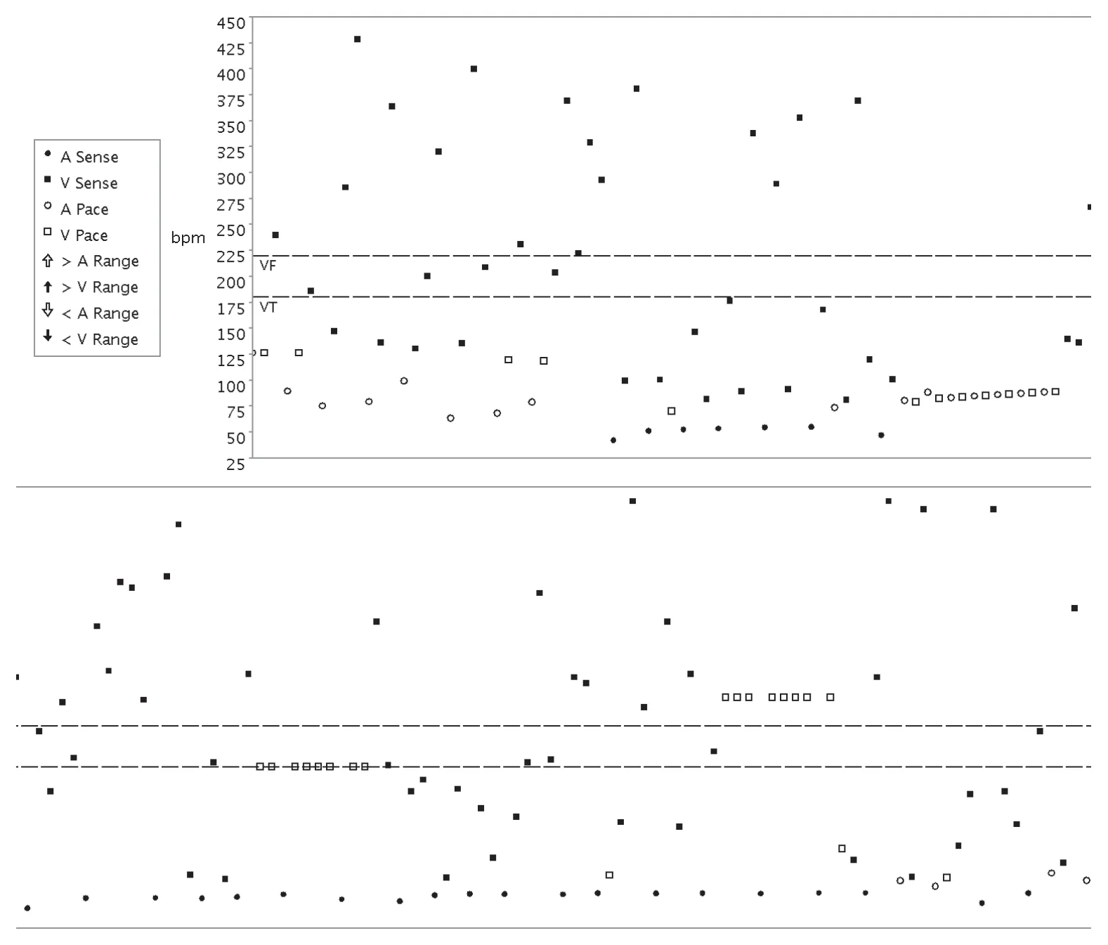 Figure — Surdétection et stimulation anti-tachycardique en zone de FV