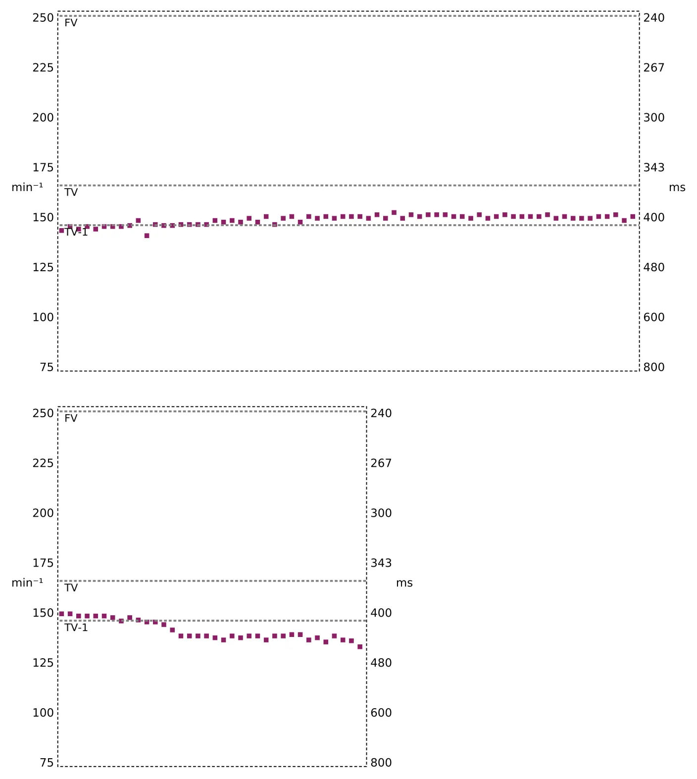 Le graphe correspondant à cet épisode est très évocateur d’une tachycardie sinusale avec une accélération progressive des cycles ventriculaires puis une décélération progressive
