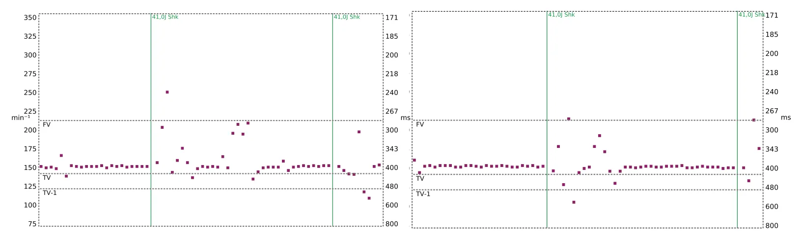 Figure — Discrimination simple chambre, ID de rythme et pourcentage de corrélation