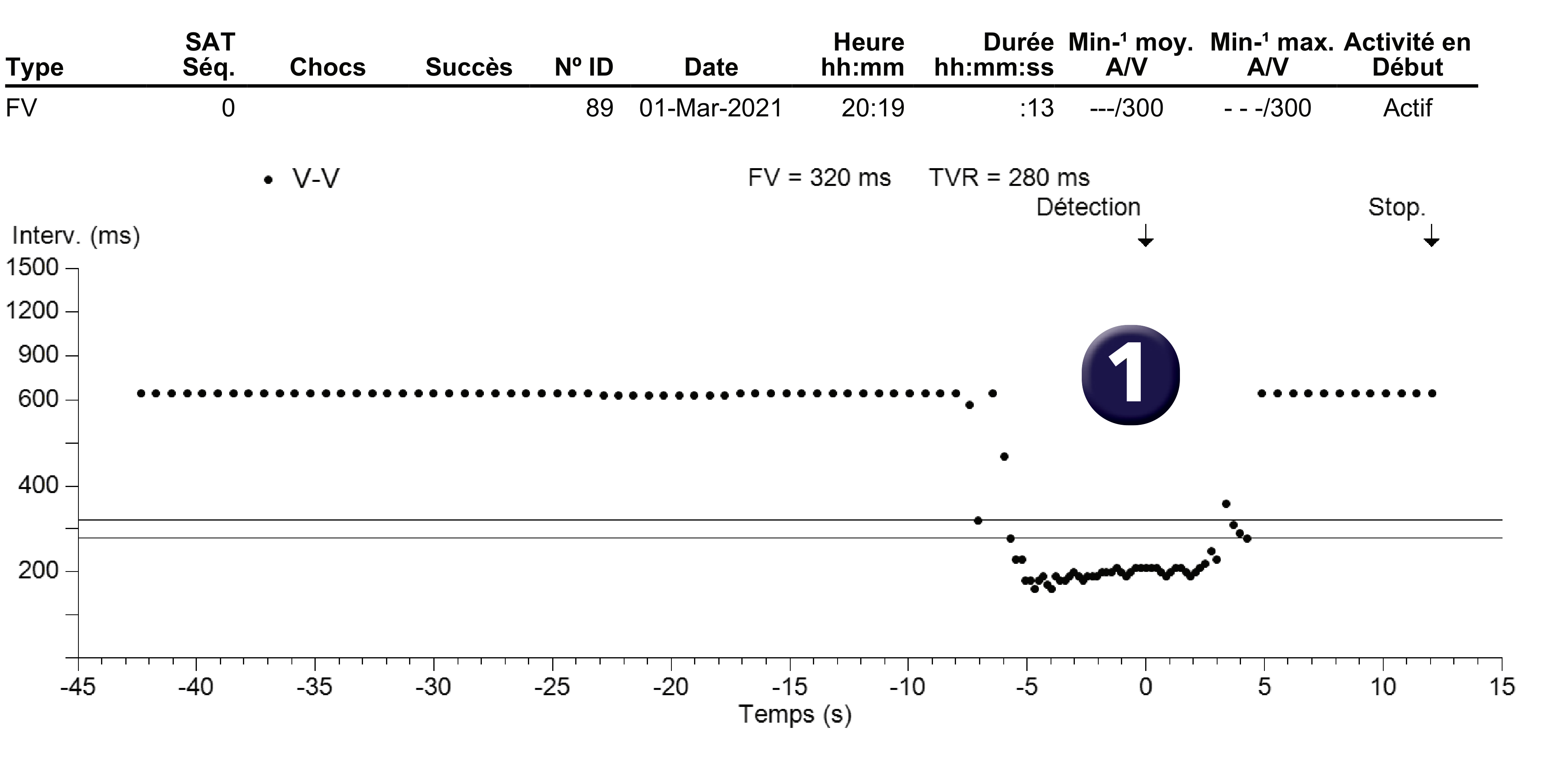 Électrogramme Medtronic DAI, segment 1 sur 1 — Réduction spontanée d’une arythmie ventriculaire