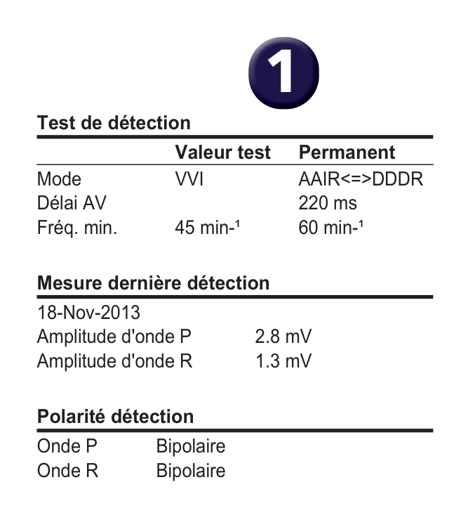 Électrogramme Medtronic DAI, segment 1 sur 2 — Quelle option de programmation en présence d’une surdétection de l’onde T ?