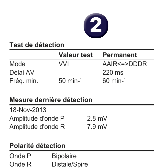 Électrogramme Medtronic DAI, segment 2 sur 2 — Quelle option de programmation en présence d’une surdétection de l’onde T ?