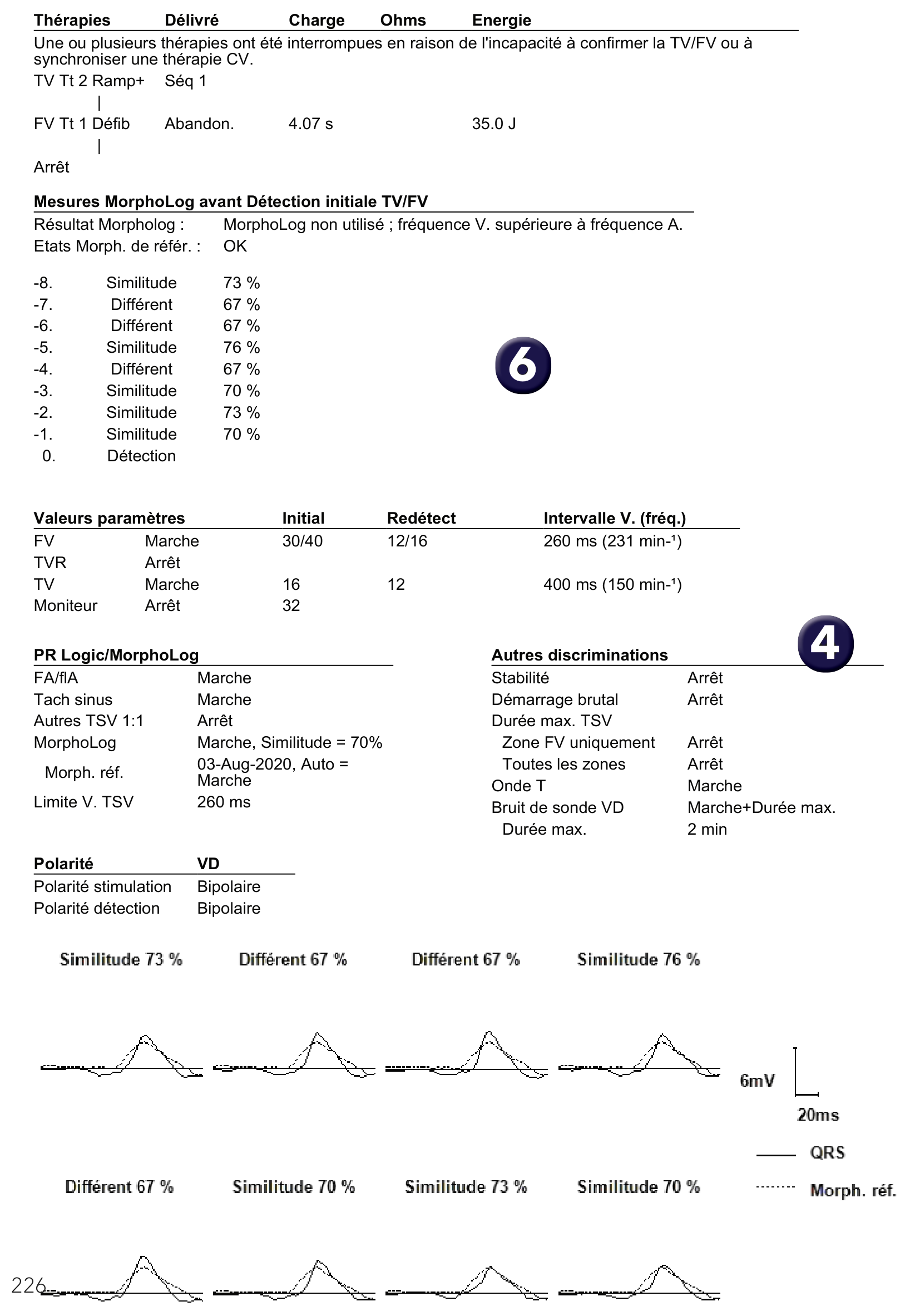 Électrogramme Medtronic DAI, segment 1 sur 1 — PR Logic versus MorphoLog