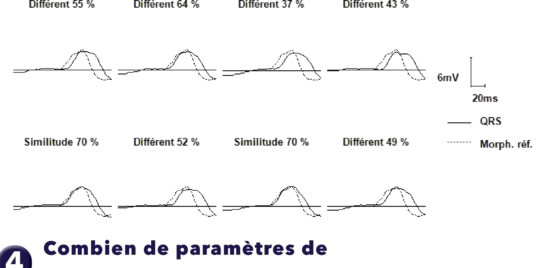 Électrogramme Medtronic DAI, segment 1 sur 2 — FA conduite, PR Logic et MorphoLog