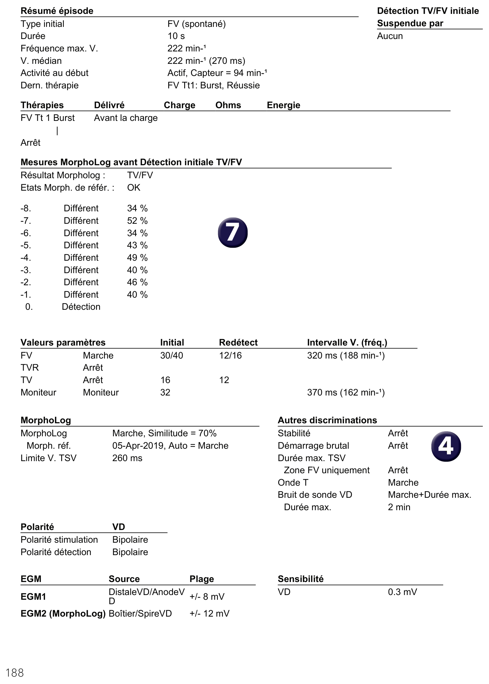 Électrogramme Medtronic DAI, segment 2 sur 2 — Défibrillateur simple chambre et nouvelles recommandations