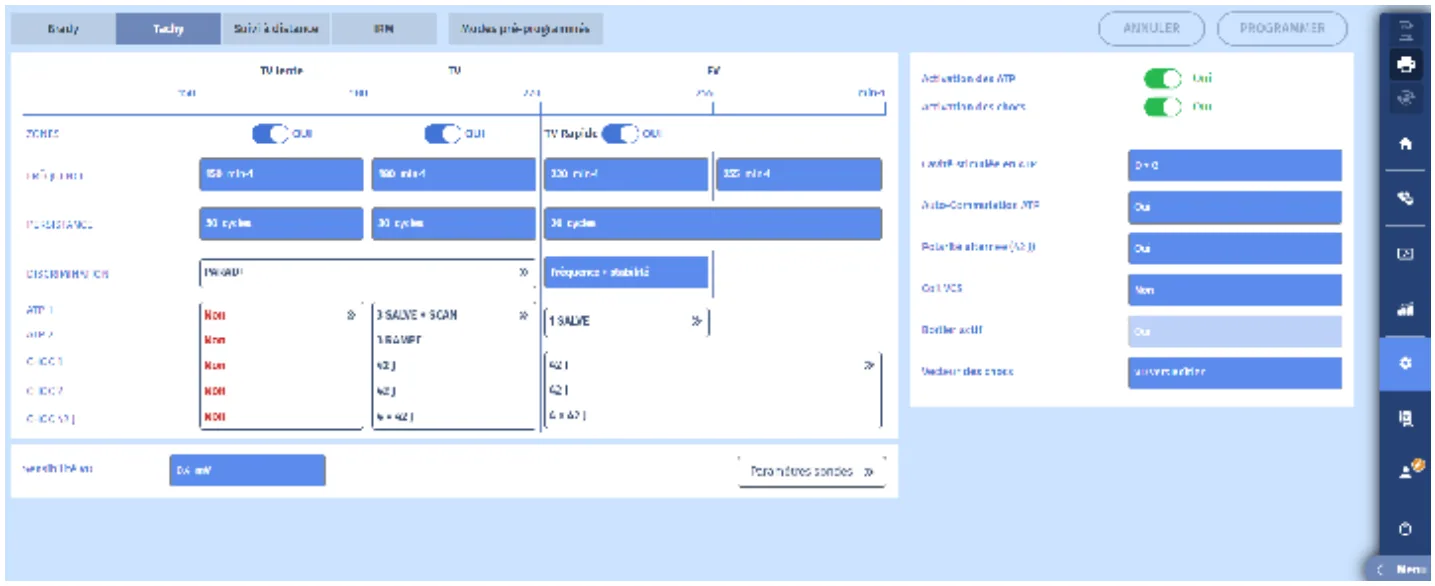 MicroPort DAI, Programmation — Comptage dans la zone de TV