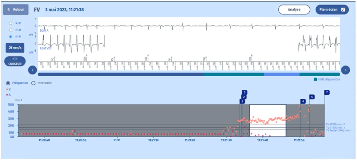 MicroPort DAI, EGM — Compteurs concurrents