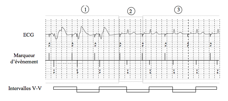 pm19_situation21.png