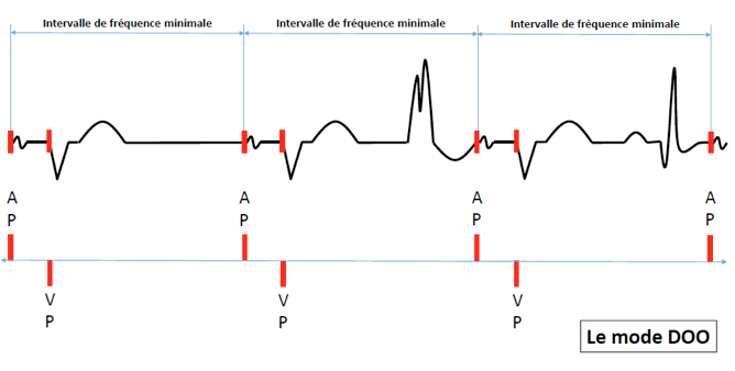 pm19_situation3.png