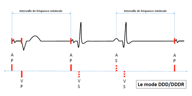 pm19_situation4.png