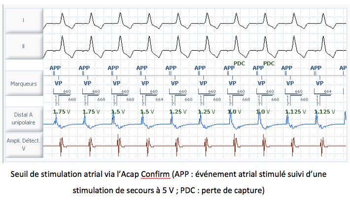 pm_19_situation_stimulation_a13.png