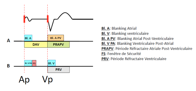 pm_19_situations_delai_atrio-ventriculaire_2.png