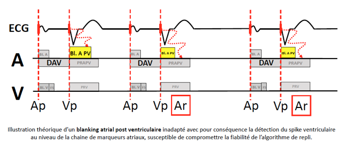 pm_19_situations_periodes_refractaires_4.png