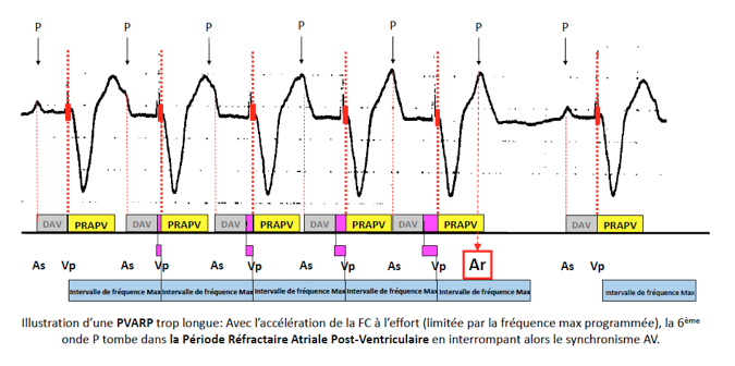 pm_19_situations_periodes_refractaires_6.png