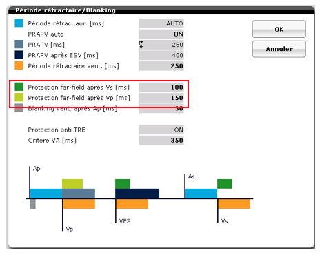 pm_19_situations_periodes_refractaires_7.png