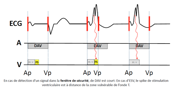 pm_19_situations_periodes_refractaires_v_4.png