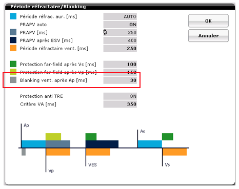 pm_19_situations_periodes_refractaires_v_5.png