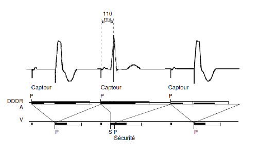 pm_19_situations_periodes_refractaires_v_8.png