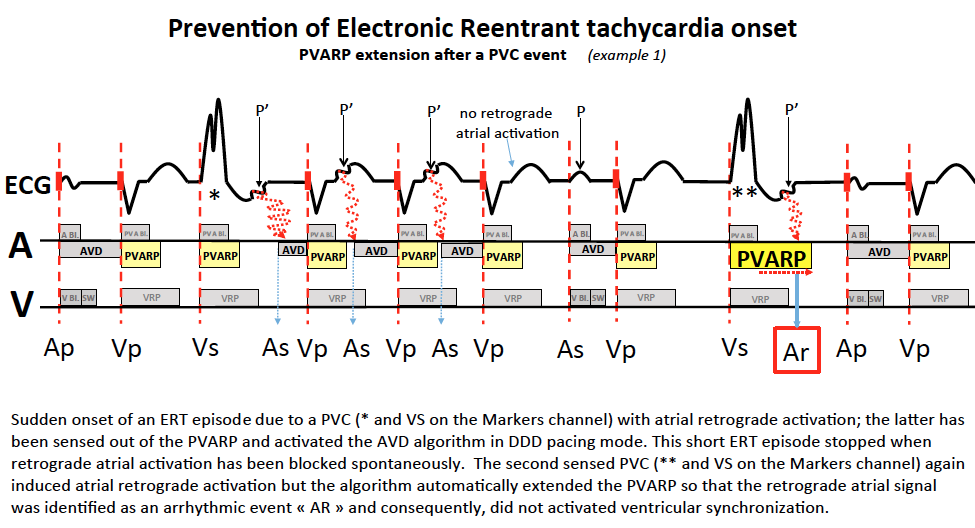 schema_va_pr10.png