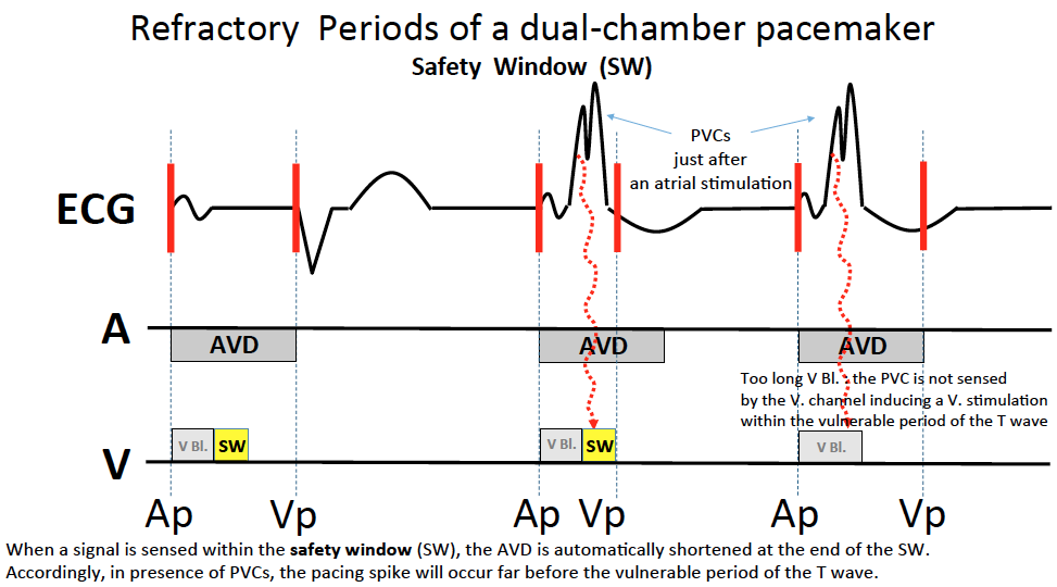 schema_va_pr3.png