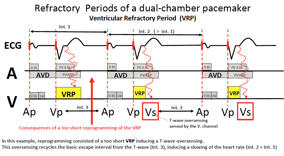 schema_va_pr4.png