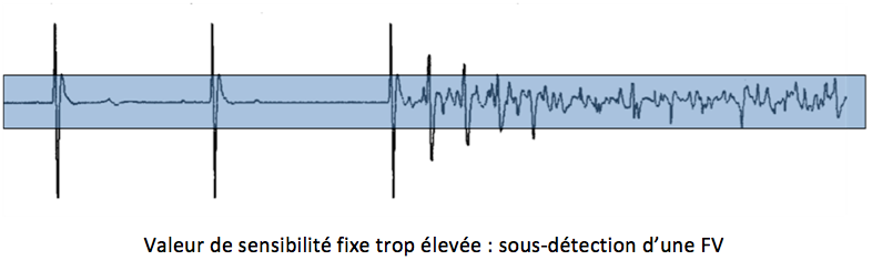 dai_20_cas_detection1.png