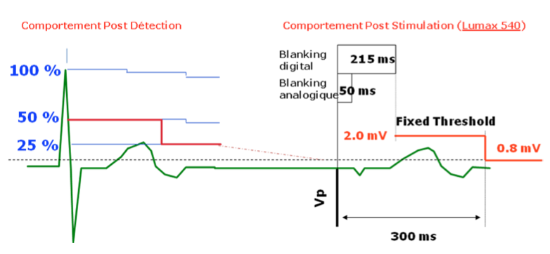 dai_20_cas_detection10.png