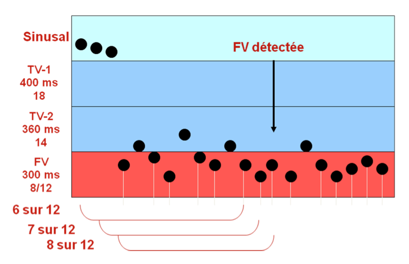 dai_20_cas_detection13.png