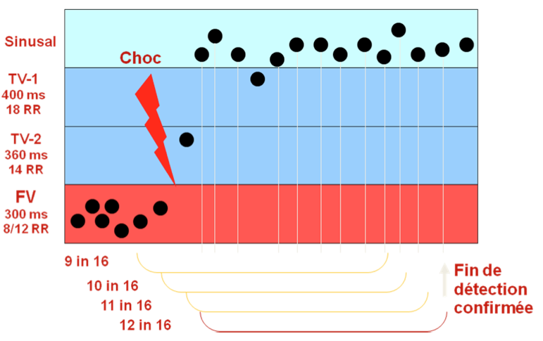 dai_20_cas_detection15.png