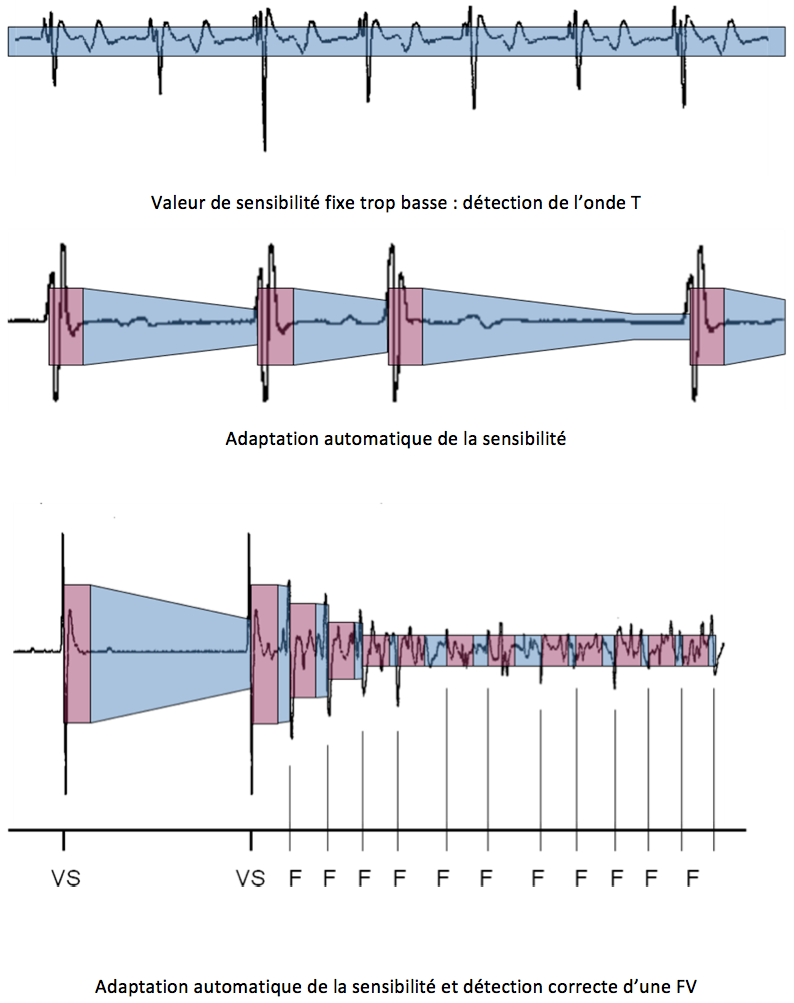 dai_20_cas_detection2.png