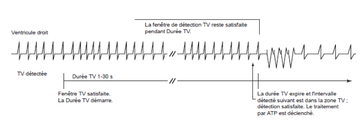 dai_20_cas_detection21.png