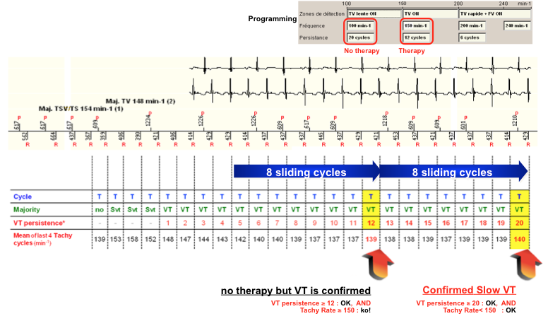 dai_20_cas_detection35.png