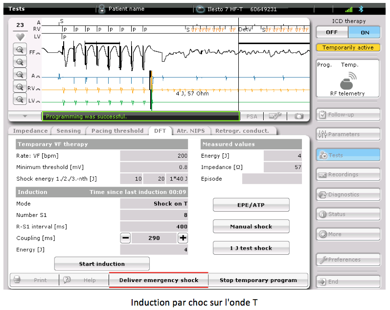 Dai 20 cas induction