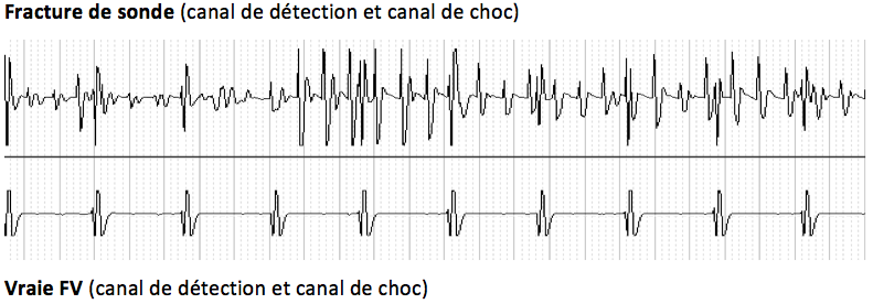 dai_20_cas_surdetection10.png