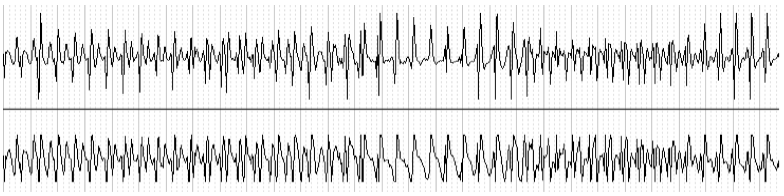 dai_20_cas_surdetection11.png