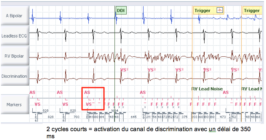 dai_20_cas_surdetection12.png