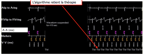 dai_discri_medtronic24.png