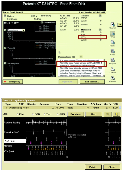 dai_discri_medtronic30a.png