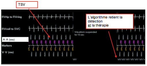 dai_discri_medtronic36.png