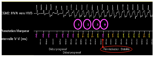 dai_discri_medtronic4.png