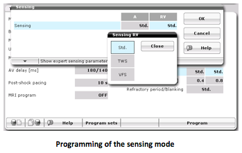 icd_biotronik_sensing1.png