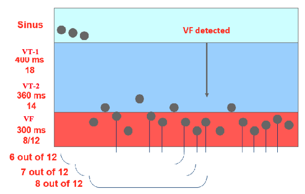 icd_biotronik_sensing11.png