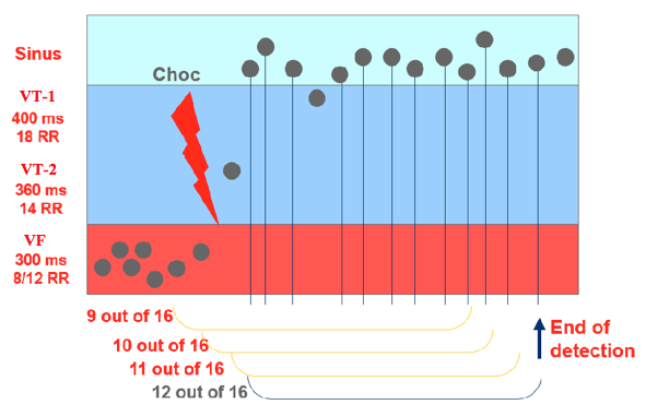 icd_biotronik_sensing13.png