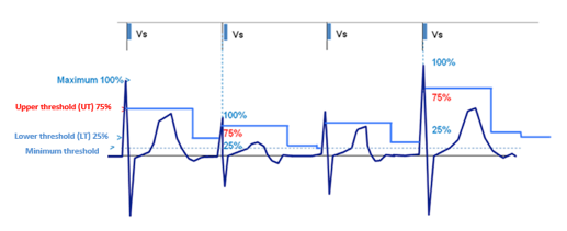 icd_biotronik_sensing3.png