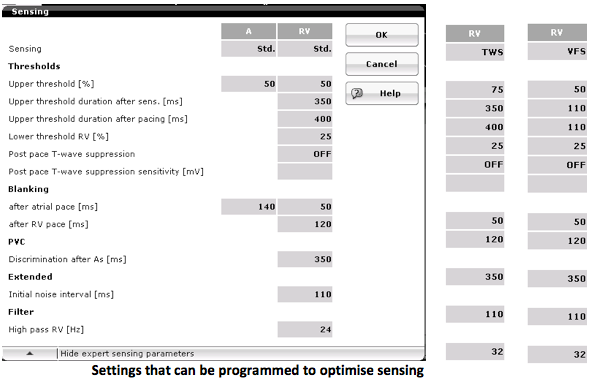 icd_biotronik_sensing5.png