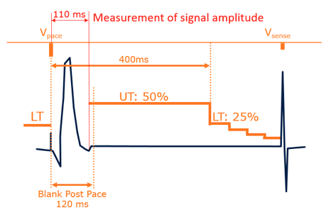 icd_biotronik_sensing6.png